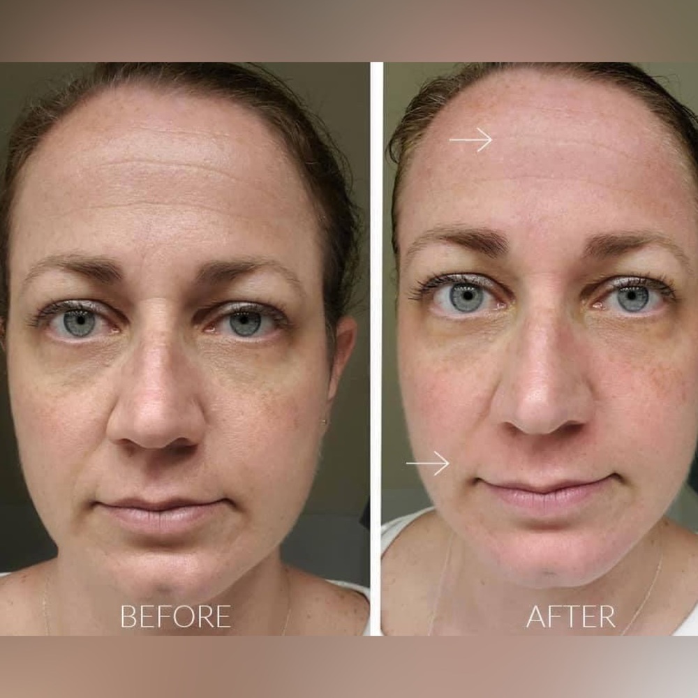 Nu Skin Face Lift with Activator (Original Formula)